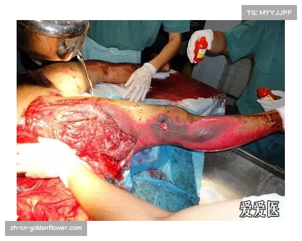 球员伤病统计分析 耻骨受伤康复时间差异较大